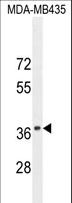 SYNCAM / CADM1 Antibody - CADM1 Antibody western blot of MDA-MB435 cell line lysates (35 ug/lane). The CADM1 antibody detected the CADM1 protein (arrow).