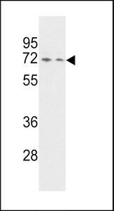 SYNCRIP / HnRNP Q Antibody - Western blot of HNRPQ Antibody in HeLa and Jurkat cell line lysates (35 ug/lane). HNRPQ (arrow) was detected using the purified antibody.