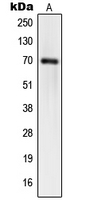 SYNCRIP / HnRNP Q Antibody - Western blot analysis of hnRNP Q expression in HT1080 (A); HeLa (B); HUVEC (C) whole cell lysates.