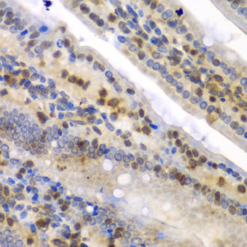 SYNCRIP / HnRNP Q Antibody - Immunohistochemistry of paraffin-embedded mouse Intestine.