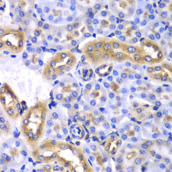 SYNCRIP / HnRNP Q Antibody - Immunohistochemistry of paraffin-embedded mouse kidney tissue.