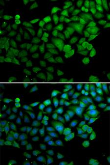 SYNCRIP / HnRNP Q Antibody - Immunofluorescence analysis of MCF7 cells.