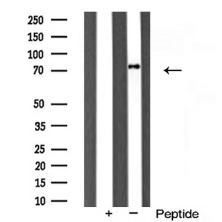 SYNCRIP / HnRNP Q Antibody - Western blot analysis of hnRNP Q expression in HT29 cells lysate.