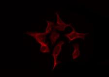 SYNCRIP / HnRNP Q Antibody - Staining HeLa cells by IF/ICC. The samples were fixed with PFA and permeabilized in 0.1% Triton X-100, then blocked in 10% serum for 45 min at 25°C. The primary antibody was diluted at 1:200 and incubated with the sample for 1 hour at 37°C. An Alexa Fluor 594 conjugated goat anti-rabbit IgG (H+L) Ab, diluted at 1/600, was used as the secondary antibody.