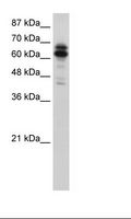 SYNCRIP / HnRNP Q Antibody - HepG2 Cell Lysate.  This image was taken for the unconjugated form of this product. Other forms have not been tested.