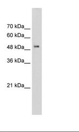 Syndapin I / PACSIN1 Antibody - Transfected 293T Cell Lysate.  This image was taken for the unconjugated form of this product. Other forms have not been tested.