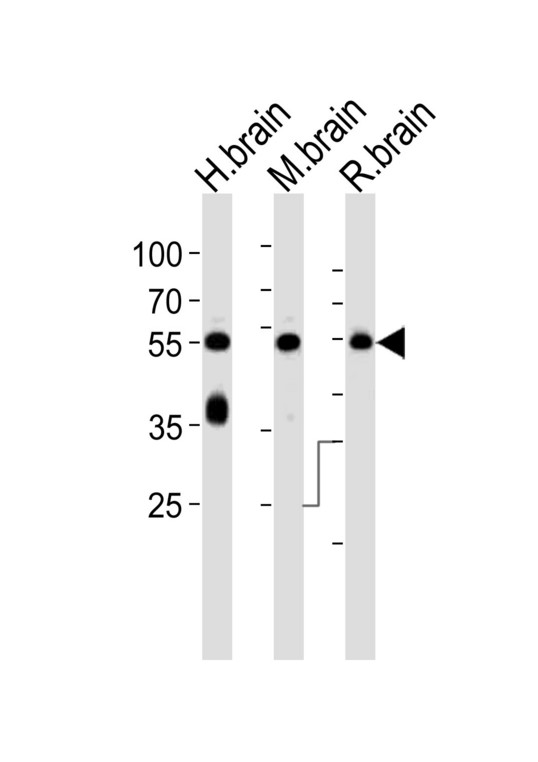 Syndapin I / PACSIN1 Antibody - Western blot of lysates from human brain, mouse brain and rat brain tissue lysate (from left to right), using PACSIN1 Antibody (G23). Antibody was diluted at 1:1000 at each lane. A goat anti-rabbit IgG H&L (HRP) at 1:10000 dilution was used as the secondary antibody. Lysates at 35ug per lane.