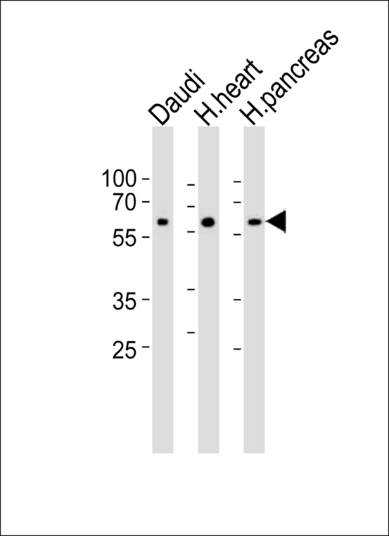 Syndapin I / PACSIN1 Antibody - Western blot of lysates from Daudi cell line, human heart and pancreas tissue lysate(from left to right), using PACSIN1 Antibody (G23). Antibody was diluted at 1:1000 at each lane. A goat anti-rabbit IgG H&L (HRP) at 1:10000 dilution was used as the secondary antibody. Lysates at 35ug per lane.