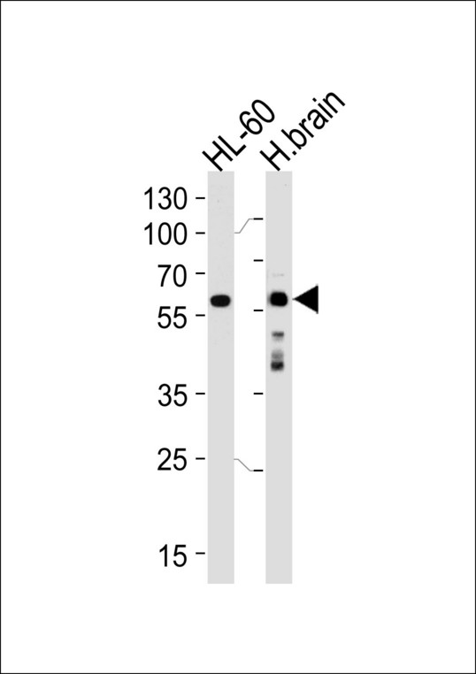 Syndapin I / PACSIN1 Antibody - Western blot of lysates from HL-60 cell line and human brain tissue lysate (from left to right), using PACSIN1 Antibody (K310). Antibody was diluted at 1:1000 at each lane. A goat anti-rabbit IgG H&L (HRP) at 1:5000 dilution was used as the secondary antibody. Lysates at 35ug per lane.