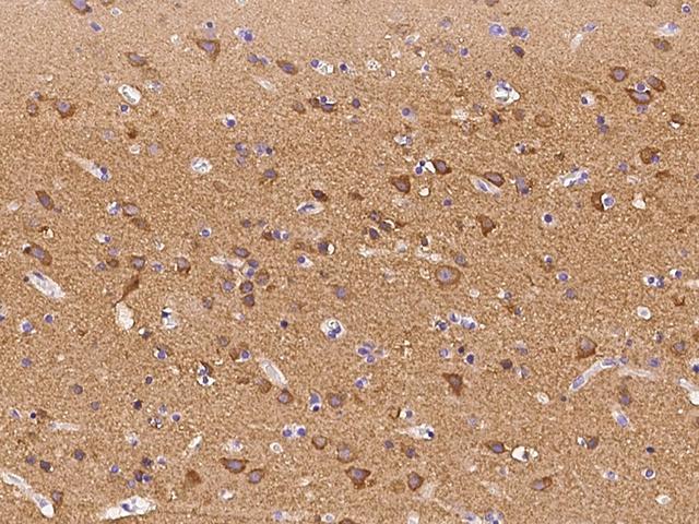 Syndapin I / PACSIN1 Antibody - Immunochemical staining PACSIN1 in human brain with rabbit polyclonal antibody at 1:300 dilution, formalin-fixed paraffin embedded sections.
