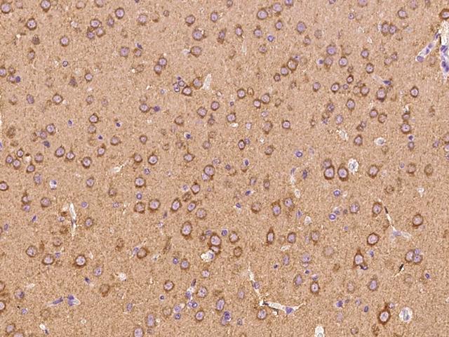 Syndapin I / PACSIN1 Antibody - Immunochemical staining PACSIN1 in rat brain with rabbit polyclonal antibody at 1:300 dilution, formalin-fixed paraffin embedded sections.