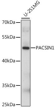 Syndapin I / PACSIN1 Antibody - Western blot analysis of extracts of U-251MG cells using PACSIN1 Polyclonal Antibody at dilution of 1:1000.