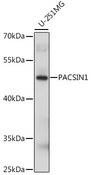 Syndapin I / PACSIN1 Antibody - Western blot analysis of extracts of U-251MG cells using PACSIN1 Polyclonal Antibody at dilution of 1:1000.