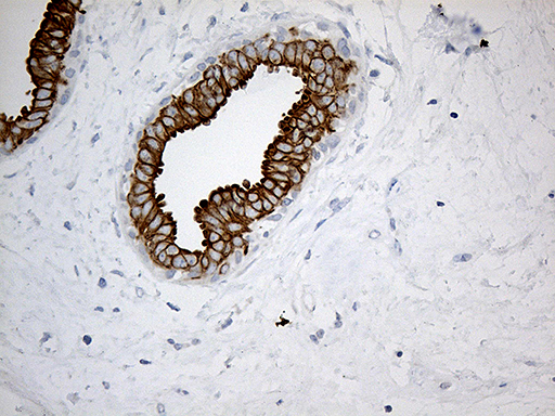 SYNE1 / Nesprin 1 Antibody - Immunohistochemical staining of paraffin-embedded Human breast tissue within the normal limits using anti-SYNE1 mouse monoclonal antibody. (Heat-induced epitope retrieval by 1mM EDTA in 10mM Tris buffer. (pH8.5) at 120°C for 3 min. (1:500)