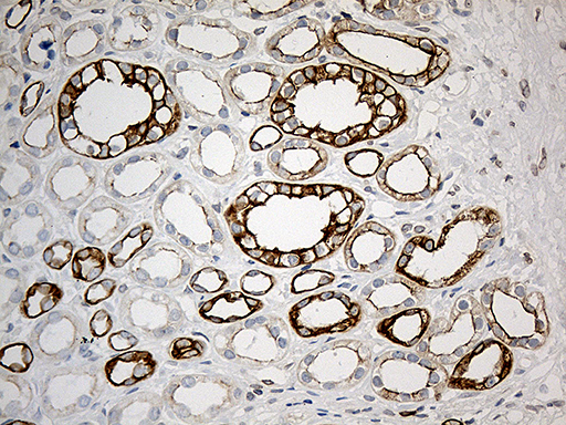 SYNE1 / Nesprin 1 Antibody - Immunohistochemical staining of paraffin-embedded Human Kidney tissue within the normal limits using anti-SYNE1 mouse monoclonal antibody. (Heat-induced epitope retrieval by 1mM EDTA in 10mM Tris buffer. (pH8.5) at 120°C for 3 min. (1:500)