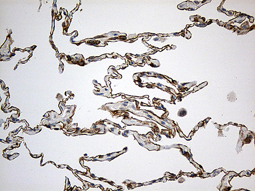 SYNE1 / Nesprin 1 Antibody - Immunohistochemical staining of paraffin-embedded Human lung tissue within the normal limits using anti-SYNE1 mouse monoclonal antibody. (Heat-induced epitope retrieval by 1mM EDTA in 10mM Tris buffer. (pH8.5) at 120°C for 3 min. (1:500)