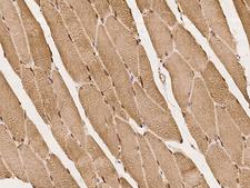 SYNE1 / Nesprin 1 Antibody - Immunochemical staining of human SYNE1 in human skeletal muscle with rabbit polyclonal antibody at 1:100 dilution, formalin-fixed paraffin embedded sections.