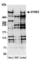 SYNE2 / Nesprin-2 Antibody - Detection of human SYNE2 by western blot. Samples: Whole cell lysate (50 µg) from HeLa, HEK293T, and Jurkat cells prepared using NETN lysis buffer. Antibody: Affinity purified rabbit anti-SYNE2 antibody used for WB at 0.4 µg/ml. Detection: Chemiluminescence with an exposure time of 30 seconds.