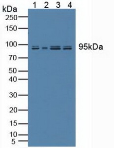 SYNE2 / Nesprin-2 Antibody - Western Blot; Sample: Lane1: Human Lung Tissue; Lane2: Human A431 Cells; Lane3: Porcine Kidney Tissue; Lane4: Porcine Stomach Tissue.