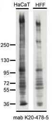 SYNE2 / Nesprin-2 Antibody