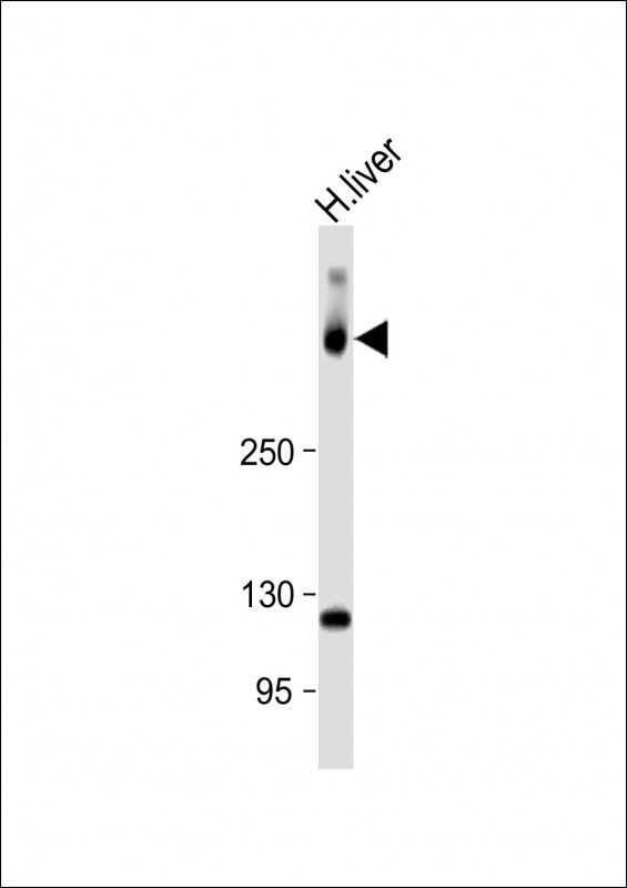 SYNE2 / Nesprin-2 Antibody - Anti-SYNE2 Antibody (N-Term) at 1:1000 dilution + Human liver lysate Lysates/proteins at 20 µg per lane. Secondary Goat Anti-Rabbit IgG, (H+L), Peroxidase conjugated at 1/10000 dilution. Predicted band size: 796 kDa Blocking/Dilution buffer: 5% NFDM/TBST.