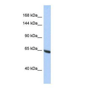 SYNE3 / C14orf49 Antibody - Western blot of Human HepG2. SYNE3 antibody dilution 1.0 ug/ml.  This image was taken for the unconjugated form of this product. Other forms have not been tested.