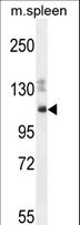 SYNE3 / C14orf49 Antibody - SYNE3 Antibody western blot of mouse spleen cell line lysates (35 ug/lane). The SYNE3 antibody detected the SYNE3 protein (arrow).