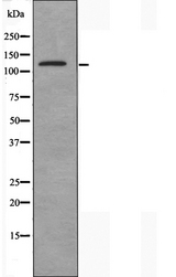 SYNE3 / C14orf49 Antibody - Western blot analysis of extracts of Jurkat cells using C14orf49 antibody.