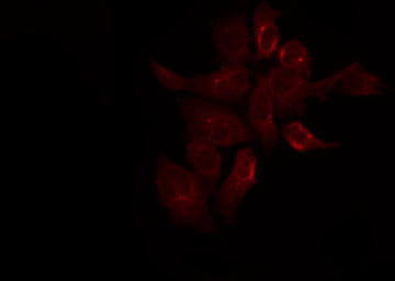 SYNE3 / C14orf49 Antibody - Staining HeLa cells by IF/ICC. The samples were fixed with PFA and permeabilized in 0.1% Triton X-100, then blocked in 10% serum for 45 min at 25°C. The primary antibody was diluted at 1:200 and incubated with the sample for 1 hour at 37°C. An Alexa Fluor 594 conjugated goat anti-rabbit IgG (H+L) Ab, diluted at 1/600, was used as the secondary antibody.