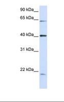 SYNE4 / C19orf46 Antibody - 293T cell lysate. Antibody concentration: 1.0 ug/ml. Gel concentration: 12%.  This image was taken for the unconjugated form of this product. Other forms have not been tested.