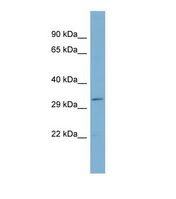 SYNE4 / C19orf46 Antibody - Western blot of Human ACHN. SYNE4 antibody dilution 1.0 ug/ml.  This image was taken for the unconjugated form of this product. Other forms have not been tested.