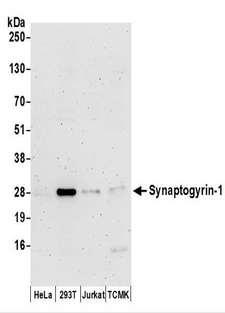 SYNGR1 / Synaptogyrin 1 Antibody - Detection of Human and Mouse Synaptogyrin-1 by Western Blot. Samples: Whole cell lysate (50 ug) prepared using NETN buffer from HeLa, 293T, Jurkat, and mouse TCMK-1 cells. Antibodies: Affinity purified rabbit anti-Synaptogyrin-1 antibody used for WB at 0.1 ug/ml. Detection: Chemiluminescence with an exposure time of 3 minutes.