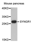 SYNGR1 / Synaptogyrin 1 Antibody - Western blot analysis of extracts of mouse pancreas.