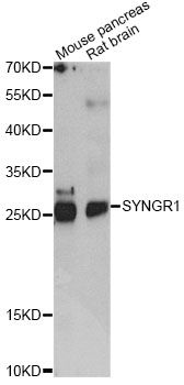 SYNGR1 / Synaptogyrin 1 Antibody - Western blot analysis of extracts of various cell lines, using SYNGR1 antibody at 1:1000 dilution. The secondary antibody used was an HRP Goat Anti-Rabbit IgG (H+L) at 1:10000 dilution. Lysates were loaded 25ug per lane and 3% nonfat dry milk in TBST was used for blocking. An ECL Kit was used for detection and the exposure time was 90s.