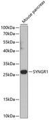 SYNGR1 / Synaptogyrin 1 Antibody - Western blot analysis of extracts of mouse pancreas using SYNGR1 Polyclonal Antibody at dilution of 1:1000.