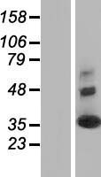 SYNGR2 / Synaptogyrin 2 Protein - Western validation with an anti-DDK antibody * L: Control HEK293 lysate R: Over-expression lysate