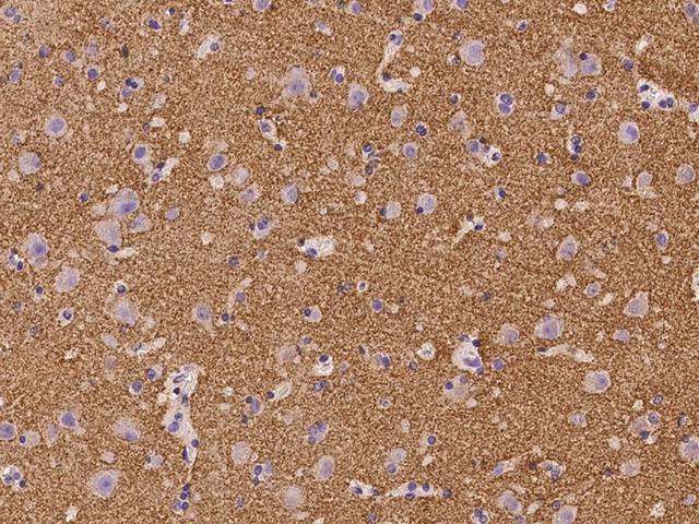 SYNGR3 / Synaptogyrin 3 Antibody - Immunochemical staining of human SYNGR3 in human brain with rabbit polyclonal antibody at 1:100 dilution, formalin-fixed paraffin embedded sections.