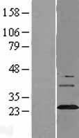SYNGR3 / Synaptogyrin 3 Protein - Western validation with an anti-DDK antibody * L: Control HEK293 lysate R: Over-expression lysate