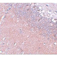 SYNGR4 / Synaptogyrin 4 Antibody - Immunohistochemistry of SYNGR4 in rat brain tissue with SYNGR4 antibody at 5 µg/mL.
