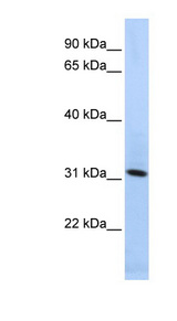 SYNGR4 / Synaptogyrin 4 Antibody - SYNGR4 / Synaptogyrin 4 antibody Western blot of HepG2 cell lysate. This image was taken for the unconjugated form of this product. Other forms have not been tested.