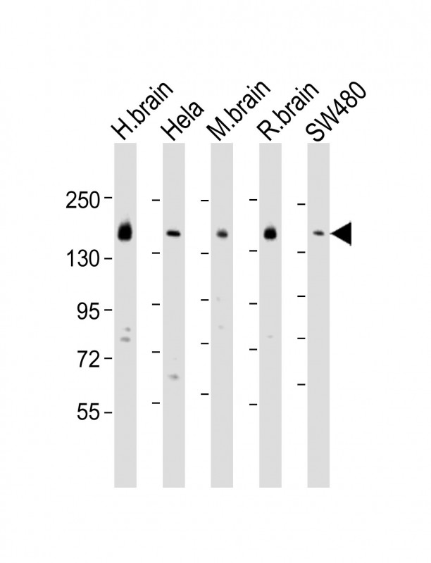 SYNJ1 / Synaptojanin Antibody - All lanes: Anti-SYNJ1 Antibody (C-term) at 1:1000-1:2000 dilution. Lane 1: human brain lysate. Lane 2: HeLa whole cell lysate. Lane 3: mouse brain lysate. Lane 4: rat brain lysate. Lane 5: SW480 whole cell lysate Lysates/proteins at 20 ug per lane. Secondary Goat Anti-Rabbit IgG, (H+L), Peroxidase conjugated at 1:10000 dilution. Predicted band size: 173 kDa. Blocking/Dilution buffer: 5% NFDM/TBST.
