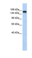 SYNJ1 / Synaptojanin Antibody - SYNJ1 / Synaptojanin antibody Western blot of HepG2 cell lysate. This image was taken for the unconjugated form of this product. Other forms have not been tested.