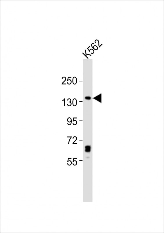 SYNJ1 / Synaptojanin Antibody - Anti-SYNJ1 Antibody at 1:2000 dilution + K562 whole cell lysates Lysates/proteins at 20 ug per lane. Secondary Goat Anti-Rabbit IgG, (H+L), Peroxidase conjugated at 1/10000 dilution Predicted band size : 173 kDa Blocking/Dilution buffer: 5% NFDM/TBST.
