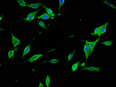 SYNJ1 / Synaptojanin Antibody - Immunofluorescence staining of NIH/3T3 cells at a dilution of 1:133, counter-stained with DAPI. The cells were fixed in 4% formaldehyde, permeabilized using 0.2% Triton X-100 and blocked in 10% normal Goat Serum. The cells were then incubated with the antibody overnight at 4 °C.The secondary antibody was Alexa Fluor 488-congugated AffiniPure Goat Anti-Rabbit IgG (H+L) .