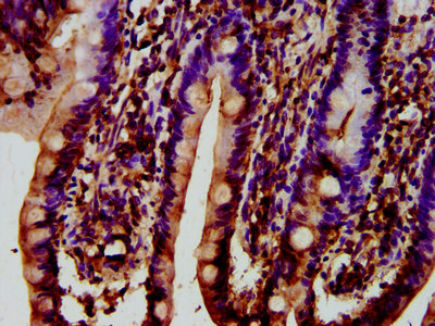 SYNJ1 / Synaptojanin Antibody - Immunohistochemistry image at a dilution of 1:400 and staining in paraffin-embedded human small intestine tissue performed on a Leica BondTM system. After dewaxing and hydration, antigen retrieval was mediated by high pressure in a citrate buffer (pH 6.0) . Section was blocked with 10% normal goat serum 30min at RT. Then primary antibody (1% BSA) was incubated at 4 °C overnight. The primary is detected by a biotinylated secondary antibody and visualized using an HRP conjugated SP system.