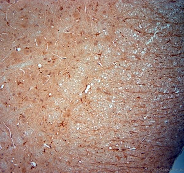 SYNJ1 / Synaptojanin Antibody - IHC-P on paraffin sections of rat spinal cord. The animal was perfused using Autoperfuser at a pressure of 130 mmHg with 300 ml 4% FA before being processed for paraffin embedding. HIER: Tris-EDTA, pH 9 for 20 min using Thermo PT Module. Blocking: 0.2% LFDM in TBST filtered through 0.2 µm. Detection was done using Novolink HRP polymer from Leica following manufacturers instructions; DAB chromogen: Candela DAB chromogen. Primary antibody: dilution 1:1000, incubated 30 min at RT using Autostainer. Sections were counterstained with Harris Hematoxylin.