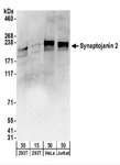 SYNJ2 / Synaptojanin 2 Antibody - Detection of Human Synaptojanin 2 by Western Blot. Samples: Whole cell lysate from 293T (15 and 50 ug), HeLa (50 ug), and Jurkat (50 ug) cells. Antibodies: Affinity purified rabbit anti-Synaptojanin 2 antibody used for WB at 1 ug/ml. Detection: Chemiluminescence with an exposure time of 30 seconds.