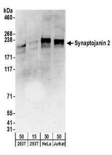 SYNJ2 / Synaptojanin 2 Antibody - Detection of Human Synaptojanin 2 by Western Blot. Samples: Whole cell lysate from 293T (15 and 50 ug), HeLa (50 ug), and Jurkat (50 ug) cells. Antibodies: Affinity purified rabbit anti-Synaptojanin 2 antibody used for WB at 1 ug/ml. Detection: Chemiluminescence with an exposure time of 30 seconds.