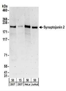 SYNJ2 / Synaptojanin 2 Antibody - Detection of Human Synaptojanin 2 by Western Blot. Samples: Whole cell lysate from 293T (15 and 50 ug), HeLa (50 ug), and Jurkat (50 ug) cells. Antibodies: Affinity purified rabbit anti-Synaptojanin 2 antibody used for WB at 0.1 ug/ml. Detection: Chemiluminescence with an exposure time of 3 minutes.