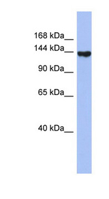 SYNJ2 / Synaptojanin 2 Antibody - SYNJ2 / Synaptojanin 2 antibody Western blot of THP-1 cell lysate. This image was taken for the unconjugated form of this product. Other forms have not been tested.